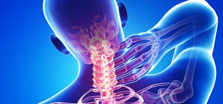 Osteochondrosis of the cervical spine