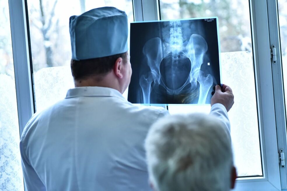 A doctor looks at a picture of a hip joint with arthrosis